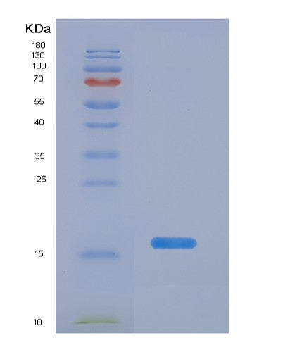 SDS-PAGE analysis of Human PPARG (Peroxisome Proliferator-Activated Receptor Gamma) - Recombinant Protein, CATHuman PPARG (Peroxisome Proliferator-Activated Receptor Gamma) - Recombinant Protein