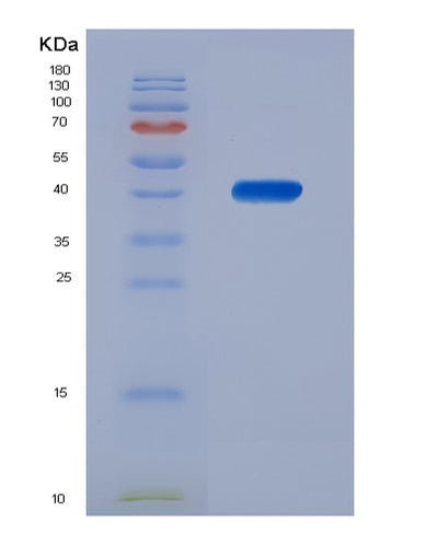 SDS-PAGE analysis of Human NR1H3 (Oxysterols Receptor Lxr-Alpha) - Recombinant Protein, CAT# BLT-07450P, showing >90% purity under 15% SDS-PAGE (Reduced)Human NR1H3 (Oxysterols Receptor Lxr-Alpha) - Recombinant Protein
