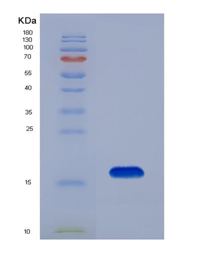 SDS-PAGE analysis of Human PPARA (Peroxisome Proliferator-Activated Receptor Alpha) - Recombinant Protein, CAT# BLT-07451P, showing >90% purity under 15% SDS-PAGE (Reduced)Human PPARA (Peroxisome Proliferator-Activated Receptor Alpha) - Recombinant Protein