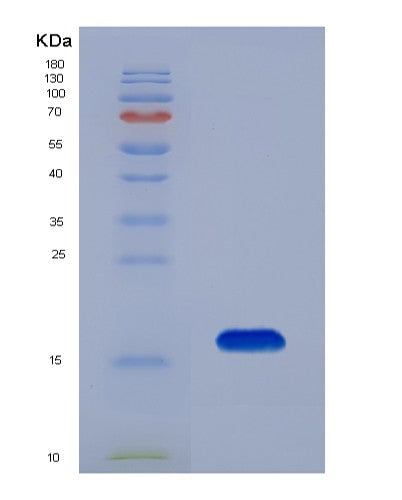 SDS-PAGE analysis of Human PPARA (Peroxisome Proliferator-Activated Receptor Alpha) - Recombinant Protein, CATHuman PPARA (Peroxisome Proliferator-Activated Receptor Alpha) - Recombinant Protein