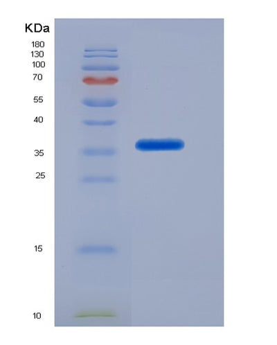 SDS-PAGE analysis of Mouse Abcg2 (Broad Substrate Specificity Atp-Binding Cassette Transporter Abcg2) - Recombinant Protein, CAT# BLT-07456P, showing >90% purity under 15% SDS-PAGE (Reduced)Mouse Abcg2 (Broad Substrate Specificity Atp-Binding Cassette Transporter Abcg2) - Recombinant Protein