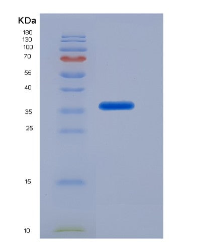 SDS-PAGE analysis of Mouse Abcg2 (Broad Substrate Specificity Atp-Binding Cassette Transporter Abcg2) - Recombinant Protein, CATMouse Abcg2 (Broad Substrate Specificity Atp-Binding Cassette Transporter Abcg2) - Recombinant Protein