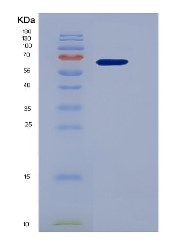 SDS-PAGE analysis of Human GMNN (Geminin) - Recombinant Protein, CAT# BLT-01185P, showing >90% purity under 15% SDS-PAGE (Reduced)Human GMNN (Geminin) - Recombinant Protein