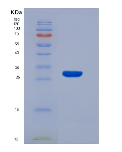SDS-PAGE analysis of Human ECI2 (Enoyl-Coa Delta Isomerase 2) - Recombinant Protein, CATHuman ECI2 (Enoyl-Coa Delta Isomerase 2) - Recombinant Protein