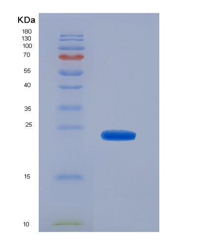 SDS-PAGE analysis of Human CD8A (T-Cell Surface Glycoprotein Cd8 Alpha Chain) - Recombinant Protein, CATHuman CD8A (T-Cell Surface Glycoprotein Cd8 Alpha Chain) - Recombinant Protein