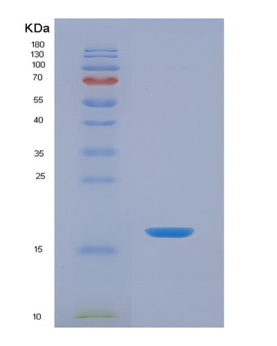 SDS-PAGE analysis of Mouse Srgn (Serglycin) - Recombinant Protein, CAT# BLT-07461P, showing >90% purity under 15% SDS-PAGE (Reduced)Mouse Srgn (Serglycin) - Recombinant Protein