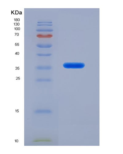 SDS-PAGE analysis of Human RNASEH2A (Ribonuclease H2 Subunit A) - Recombinant Protein, CAT# BLT-02594P, showing >90% purity under 15% SDS-PAGE (Reduced)Human RNASEH2A (Ribonuclease H2 Subunit A) - Recombinant Protein