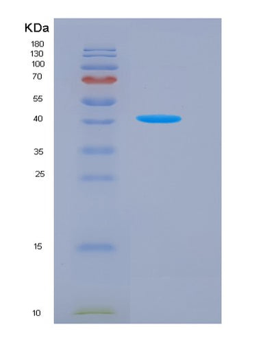SDS-PAGE analysis of Human CDC123 (Translation Initiation Factor Eif2 Assembly Protein) - Recombinant Protein, CAT# BLT-00527P, showing >90% purity under 15% SDS-PAGE (Reduced)Human CDC123 (Translation Initiation Factor Eif2 Assembly Protein) - Recombinant Protein