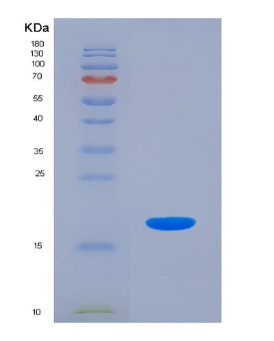 SDS-PAGE analysis of Human CDC123 (Translation Initiation Factor Eif2 Assembly Protein) - Recombinant Protein, CAT# BLT-07462P, showing >90% purity under 15% SDS-PAGE (Reduced)Human CDC123 (Translation Initiation Factor Eif2 Assembly Protein) - Recombinant Protein