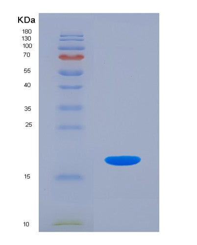 SDS-PAGE analysis of Human CDC123 (Translation Initiation Factor Eif2 Assembly Protein) - Recombinant Protein, CATHuman CDC123 (Translation Initiation Factor Eif2 Assembly Protein) - Recombinant Protein