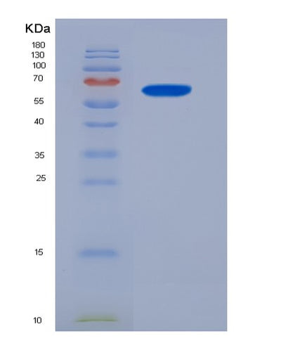 SDS-PAGE analysis of Human BEST1 (Bestrophin-1) - Recombinant Protein, CAT# BLT-00314P, showing >85% purity under 15% SDS-PAGE (Reduced)Human BEST1 (Bestrophin-1) - Recombinant Protein