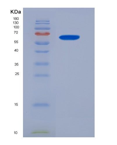 SDS-PAGE analysis of Human BEST1 (Bestrophin-1) - Recombinant Protein, CATHuman BEST1 (Bestrophin-1) - Recombinant Protein