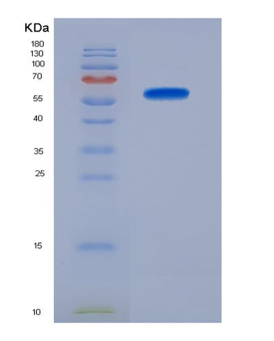 SDS-PAGE analysis of Mouse Tgfbr3 (Transforming Growth Factor Beta Receptor Type 3) - Recombinant Protein, CAT# BLT-07464P, showing >90% purity under 15% SDS-PAGE (Reduced)Mouse Tgfbr3 (Transforming Growth Factor Beta Receptor Type 3) - Recombinant Protein