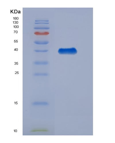 SDS-PAGE analysis of Human Creatine Kinase M+B (CKMB) - Recombinant Protein, CAT# BLT-07468P, showing >90% purity under 15% SDS-PAGE (Reduced)Human Creatine Kinase M+B (CKMB) - Recombinant Protein