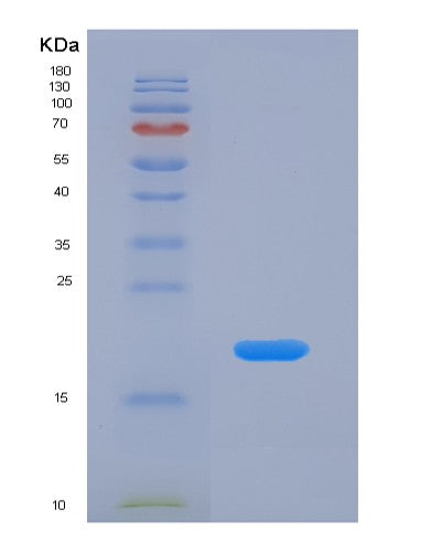 SDS-PAGE analysis of Human VAPB (Vesicle-Associated Membrane Protein-Associated Protein B/C) - Recombinant Protein, CATHuman VAPB (Vesicle-Associated Membrane Protein-Associated Protein B/C) - Recombinant Protein