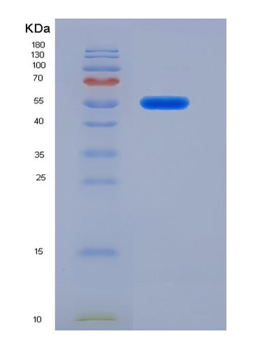 SDS-PAGE analysis of Human FARS2 (Phenylalanine--Trna Ligase, Mitochondrial) - Recombinant Protein, CAT# BLT-01051P, showing >95% purity under 15% SDS-PAGE (Reduced)Human FARS2 (Phenylalanine--Trna Ligase, Mitochondrial) - Recombinant Protein