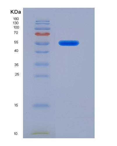 SDS-PAGE analysis of Human FARS2 (Phenylalanine--Trna Ligase, Mitochondrial) - Recombinant Protein, CATHuman FARS2 (Phenylalanine--Trna Ligase, Mitochondrial) - Recombinant Protein
