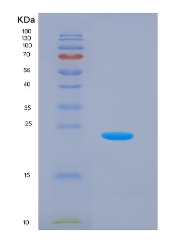 SDS-PAGE analysis of Human LYPLA2 (Acyl-Protein Thioesterase 2) - Recombinant Protein, CAT# BLT-05420P, showing >90% purity under 15% SDS-PAGE (Reduced)Human LYPLA2 (Acyl-Protein Thioesterase 2) - Recombinant Protein