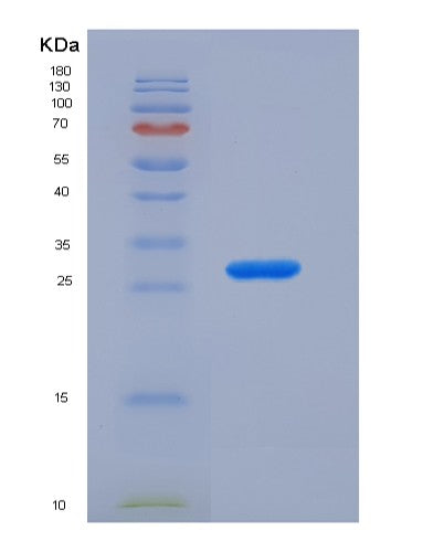 SDS-PAGE analysis of Human APOM (Apolipoprotein M) - Recombinant Protein, CATHuman APOM (Apolipoprotein M) - Recombinant Protein