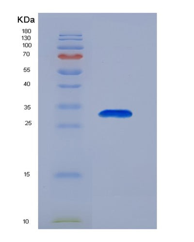 SDS-PAGE analysis of Human STAMBP (Stam-Binding Protein) - Recombinant Protein, CAT# BLT-02886P, showing >90% purity under 15% SDS-PAGE (Reduced)Human STAMBP (Stam-Binding Protein) - Recombinant Protein
