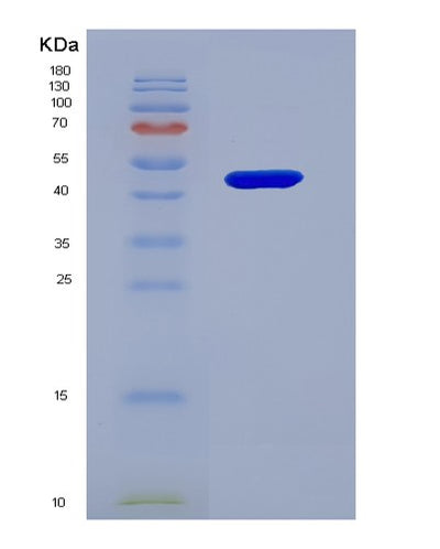 SDS-PAGE analysis of Human SERPINC1 (Antithrombin-Iii) - Recombinant Protein, CAT# BLT-02745P, showing >85% purity under 15% SDS-PAGE (Reduced)Human SERPINC1 (Antithrombin-Iii) - Recombinant Protein