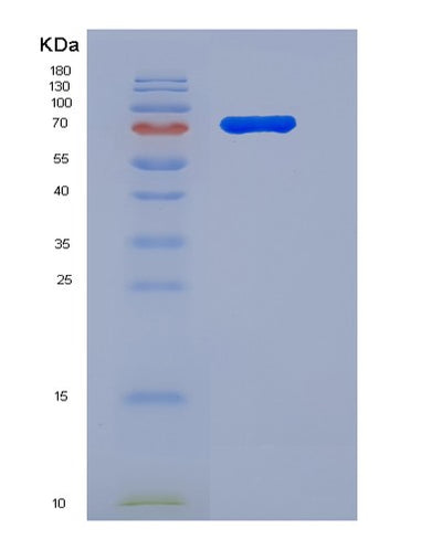 SDS-PAGE analysis of Human BRD1 (Bromodomain-Containing Protein 1) - Recombinant Protein, CAT# BLT-00353P, showing >90% purity under 15% SDS-PAGE (Reduced)Human BRD1 (Bromodomain-Containing Protein 1) - Recombinant Protein