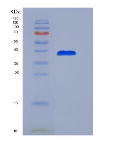 SDS-PAGE analysis of Human CXCL14 (C-X-C Motif Chemokine 14) - Recombinant Protein, CAT# BLT-04342P, showing >90% purity under 15% SDS-PAGE (Reduced)Human CXCL14 (C-X-C Motif Chemokine 14) - Recombinant Protein