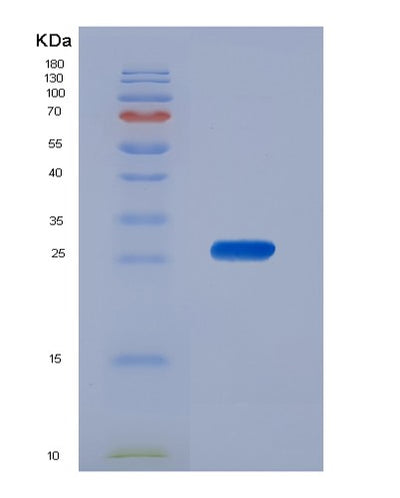 SDS-PAGE analysis of Human BAG2 (Bag Family Molecular Chaperone Regulator 2) - Recombinant Protein, CAT# BLT-04825P, showing >90% purity under 15% SDS-PAGE (Reduced)Human BAG2 (Bag Family Molecular Chaperone Regulator 2) - Recombinant Protein