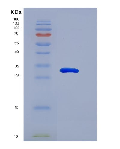 SDS-PAGE analysis of Human SNAI1 (Zinc Finger Protein Snai1) - Recombinant Protein, CAT# BLT-02813P, showing >90% purity under 15% SDS-PAGE (Reduced)Human SNAI1 (Zinc Finger Protein Snai1) - Recombinant Protein
