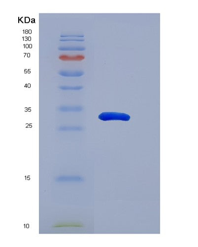 SDS-PAGE analysis of Human SNAI1 (Zinc Finger Protein Snai1) - Recombinant Protein, CATHuman SNAI1 (Zinc Finger Protein Snai1) - Recombinant Protein