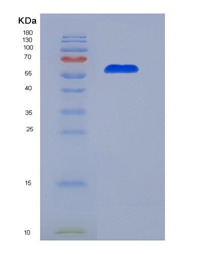 SDS-PAGE analysis of Human ABCB1 (Atp-Dependent Translocase Abcb1) - Recombinant Protein, CATHuman ABCB1 (Atp-Dependent Translocase Abcb1) - Recombinant Protein