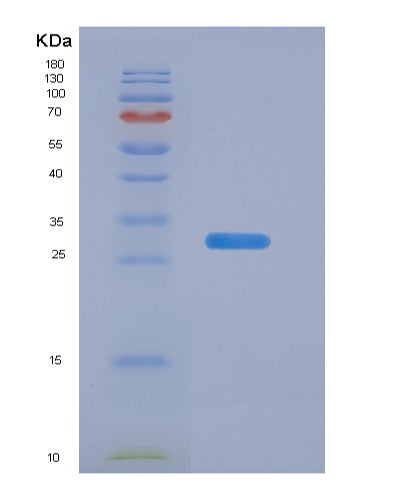 SDS-PAGE analysis of Mouse Abcb1b (Atp-Dependent Translocase Abcb1) - Recombinant Protein, CATMouse Abcb1b (Atp-Dependent Translocase Abcb1) - Recombinant Protein