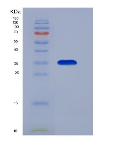 SDS-PAGE analysis of Human MBD3 (Methyl-Cpg-Binding Domain Protein 3) - Recombinant Protein, CAT# BLT-01808P, showing >85% purity under 15% SDS-PAGE (Reduced)Human MBD3 (Methyl-Cpg-Binding Domain Protein 3) - Recombinant Protein