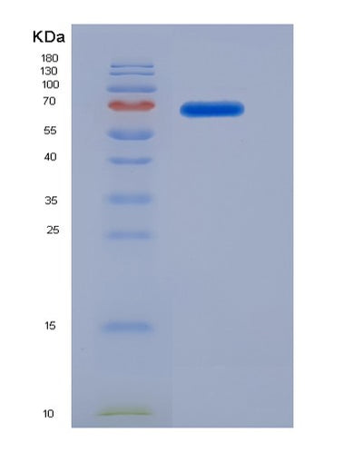 SDS-PAGE analysis of Human ADH1C (Alcohol Dehydrogenase 1C) - Recombinant Protein, CAT# BLT-00061P, showing >85% purity under 15% SDS-PAGE (Reduced)Human ADH1C (Alcohol Dehydrogenase 1C) - Recombinant Protein