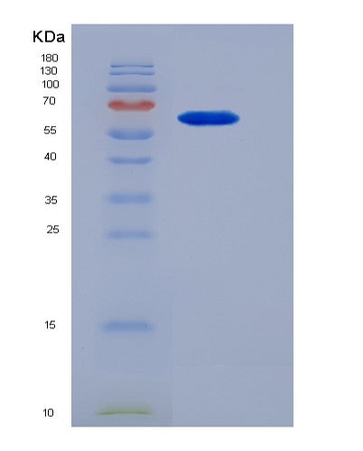 SDS-PAGE analysis of Human ALDH1A1 (Aldehyde Dehydrogenase 1A1) - Recombinant Protein, CATHuman ALDH1A1 (Aldehyde Dehydrogenase 1A1) - Recombinant Protein