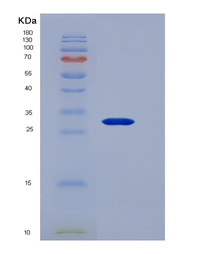 SDS-PAGE analysis of Human GLUD1 (Glutamate Dehydrogenase 1, Mitochondrial) - Recombinant Protein, CATHuman GLUD1 (Glutamate Dehydrogenase 1, Mitochondrial) - Recombinant Protein