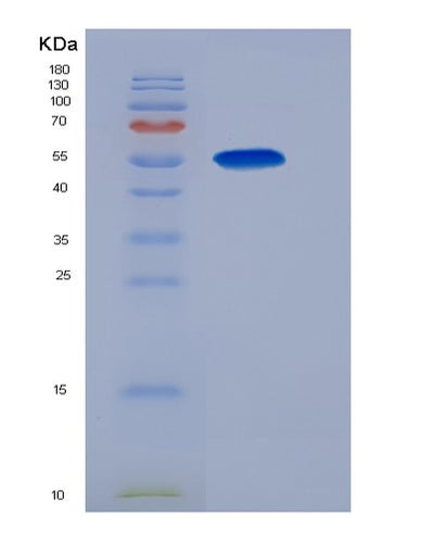 SDS-PAGE analysis of Human GSR (Glutathione Reductase, Mitochondrial) - Recombinant Protein, CAT# BLT-01281P, showing >95% purity under 15% SDS-PAGE (Reduced)Human GSR (Glutathione Reductase, Mitochondrial) - Recombinant Protein
