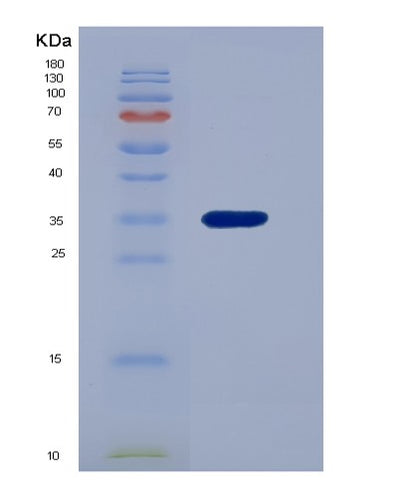 SDS-PAGE analysis of Human PNP (Purine Nucleoside Phosphorylase) - Recombinant Protein, CAT# BLT-02304P, showing >95% purity under 15% SDS-PAGE (Reduced)Human PNP (Purine Nucleoside Phosphorylase) - Recombinant Protein