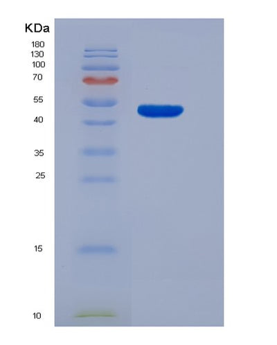 SDS-PAGE analysis of Human HPRT1 (Hypoxanthine-Guanine Phosphoribosyltransferase) - Recombinant Protein, CAT# BLT-04503P, showing >95% purity under 15% SDS-PAGE (Reduced)Human HPRT1 (Hypoxanthine-Guanine Phosphoribosyltransferase) - Recombinant Protein