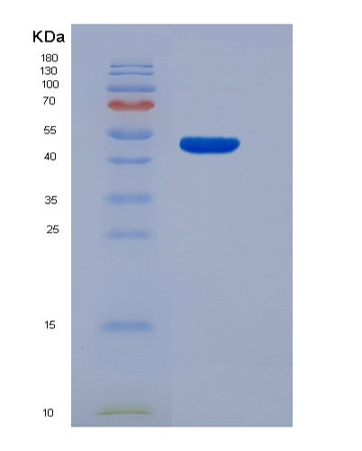 SDS-PAGE analysis of Human HPRT1 (Hypoxanthine-Guanine Phosphoribosyltransferase) - Recombinant Protein, CATHuman HPRT1 (Hypoxanthine-Guanine Phosphoribosyltransferase) - Recombinant Protein