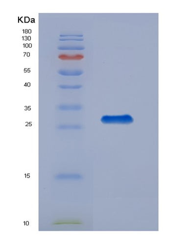SDS-PAGE analysis of Human ABL1 (Tyrosine-Protein Kinase Abl1) - Recombinant Protein, CAT# BLT-00010P, showing >95% purity under 15% SDS-PAGE (Reduced)Human ABL1 (Tyrosine-Protein Kinase Abl1) - Recombinant Protein