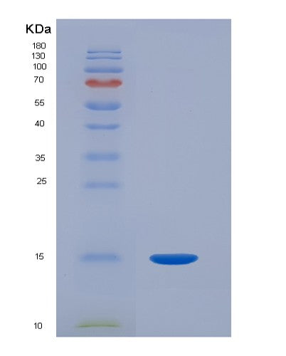 SDS-PAGE analysis of Human HP (Haptoglobin) - Recombinant Protein, CATHuman HP (Haptoglobin) - Recombinant Protein