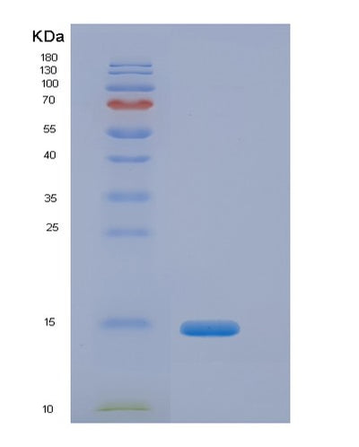 SDS-PAGE analysis of Human CFB (Complement Factor B) - Recombinant Protein, CAT# BLT-00571P, showing >90% purity under 15% SDS-PAGE (Reduced)Human CFB (Complement Factor B) - Recombinant Protein