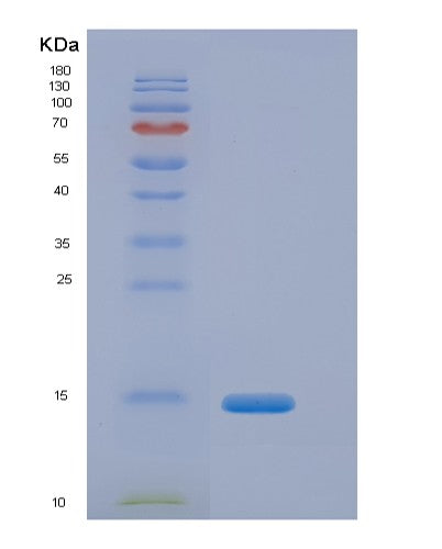 SDS-PAGE analysis of Human CFB (Complement Factor B) - Recombinant Protein, CATHuman CFB (Complement Factor B) - Recombinant Protein