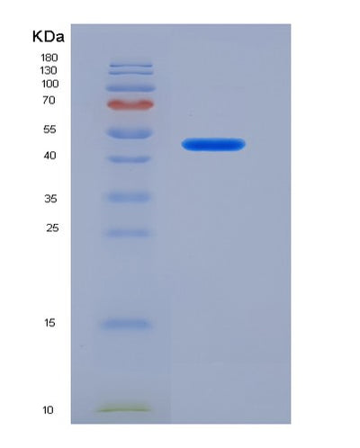 SDS-PAGE analysis of Human ASS1 (Argininosuccinate Synthase) - Recombinant Protein, CAT# BLT-00248P, showing >90% purity under 15% SDS-PAGE (Reduced)Human ASS1 (Argininosuccinate Synthase) - Recombinant Protein