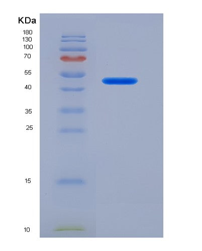 SDS-PAGE analysis of Human ASS1 (Argininosuccinate Synthase) - Recombinant Protein, CATHuman ASS1 (Argininosuccinate Synthase) - Recombinant Protein