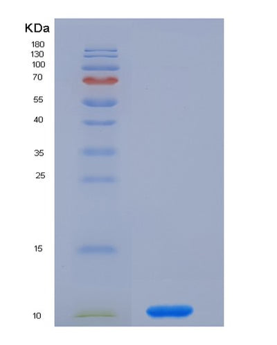 SDS-PAGE analysis of Human OAS1 (2'-5'-Oligoadenylate Synthase 1) - Recombinant Protein, CAT# BLT-02105P, showing >90% purity under 15% SDS-PAGE (Reduced)Human OAS1 (2'-5'-Oligoadenylate Synthase 1) - Recombinant Protein