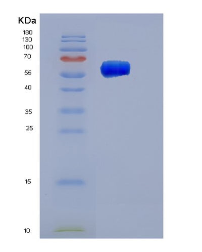 SDS-PAGE analysis of Human SERPINC1 (Antithrombin-Iii) - Recombinant Protein, CAT# BLT-06097P, showing >85% purity under 15% SDS-PAGE (Reduced)Human SERPINC1 (Antithrombin-Iii) - Recombinant Protein