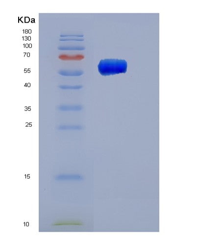 SDS-PAGE analysis of Human SERPINC1 (Antithrombin-Iii) - Recombinant Protein, CATHuman SERPINC1 (Antithrombin-Iii) - Recombinant Protein