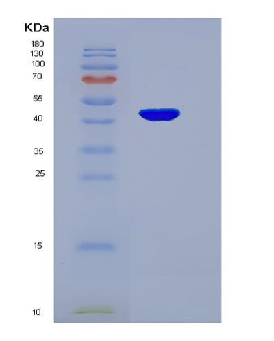 SDS-PAGE analysis of Human SERPINA1 (Alpha-1-Antitrypsin) - Recombinant Protein, CAT# BLT-00167P, showing >95% purity under 15% SDS-PAGE (Reduced)Human SERPINA1 (Alpha-1-Antitrypsin) - Recombinant Protein